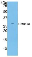 Western blot - Anti-CD11d antibody (AB231622)