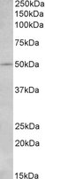 Western blot - Anti-CD127 antibody (AB118281)
