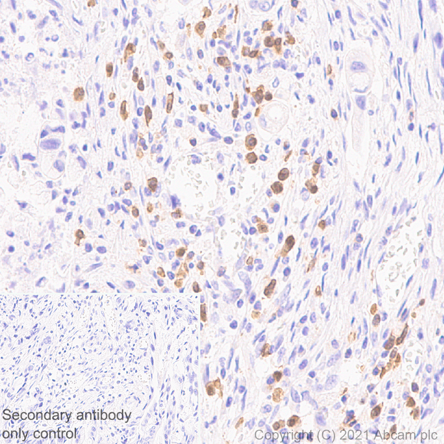 Immunohistochemistry (Formalin/PFA-fixed paraffin-embedded sections) - Anti-CD127 antibody [EPR23747-333] (AB259806)