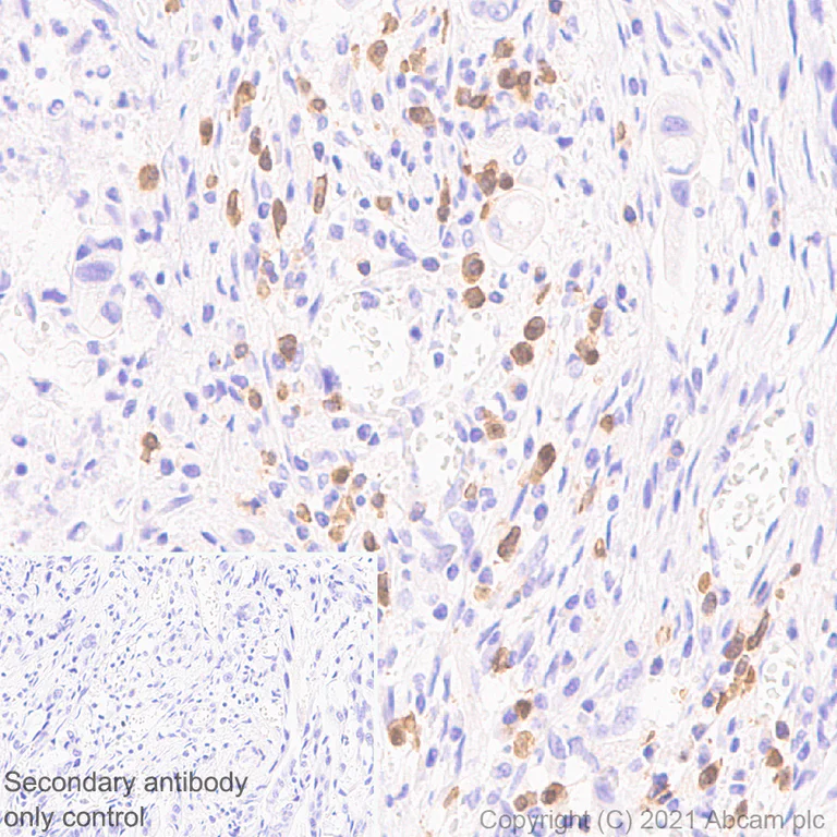 Immunohistochemistry (Formalin/PFA-fixed paraffin-embedded sections) - Anti-CD127 antibody [EPR23747-333] (AB259806)