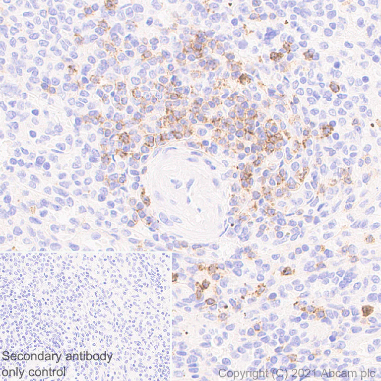 Immunohistochemistry (Formalin/PFA-fixed paraffin-embedded sections) - Anti-CD127 antibody [EPR23747-333] (AB259806)