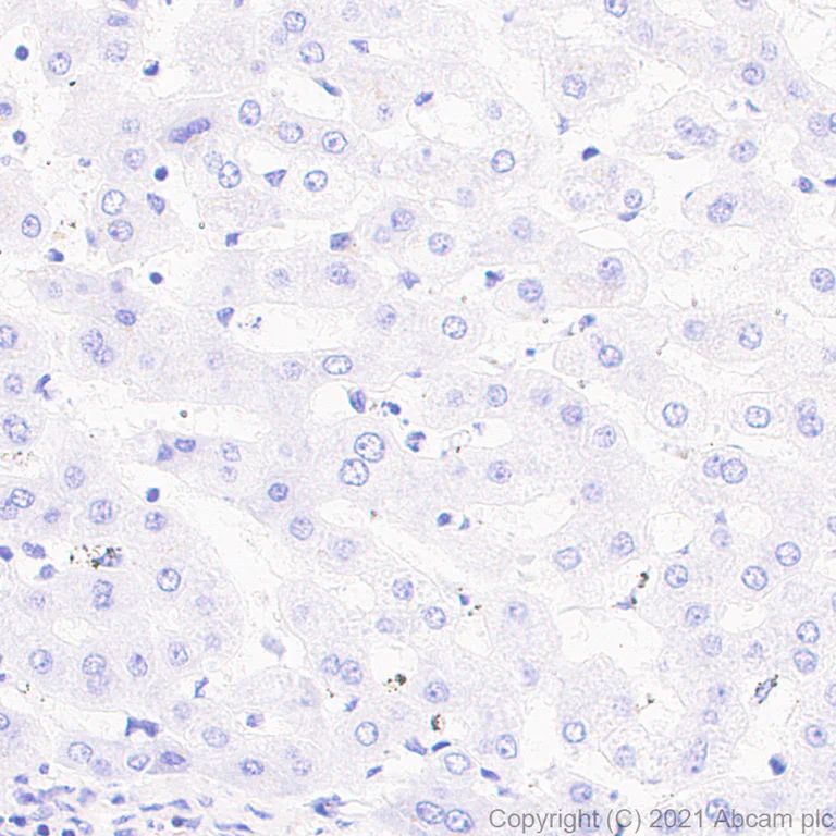 Immunohistochemistry (Formalin/PFA-fixed paraffin-embedded sections) - Anti-CD127 antibody [EPR23747-333] - BSA and Azide free (AB282011)