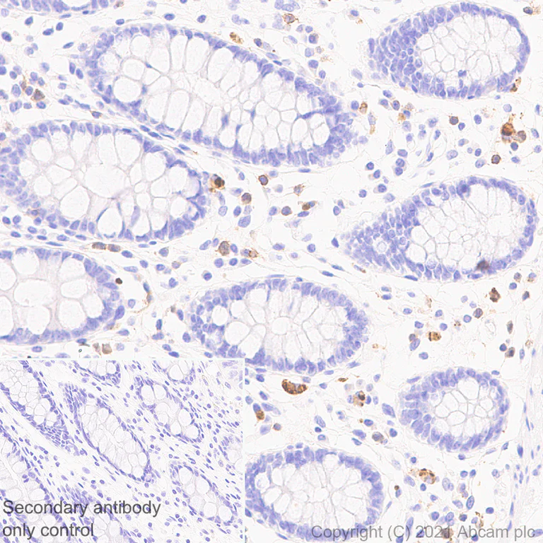 Immunohistochemistry (Formalin/PFA-fixed paraffin-embedded sections) - Anti-CD127 antibody [EPR23747-333] - BSA and Azide free (AB282011)