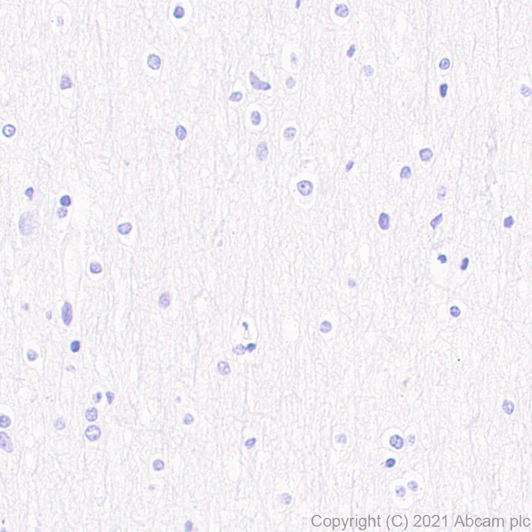 Immunohistochemistry (Formalin/PFA-fixed paraffin-embedded sections) - Anti-CD127 antibody [EPR23747-333] - BSA and Azide free (AB282011)
