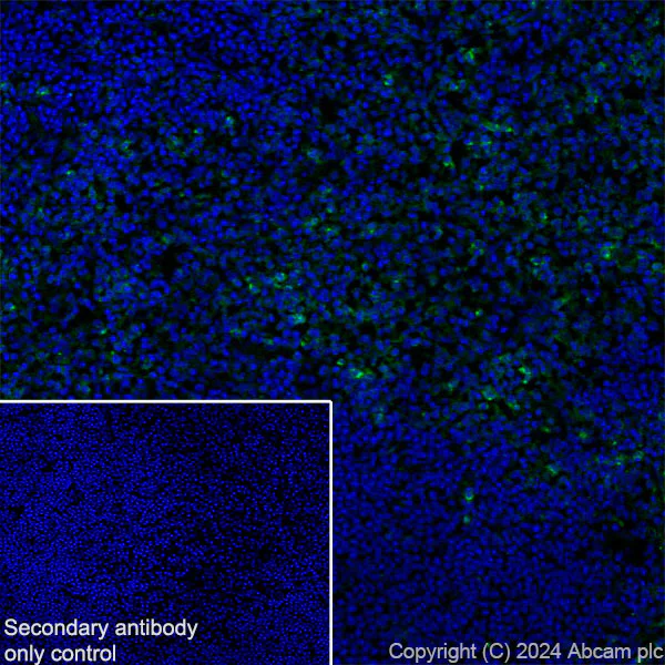 Immunohistochemistry (Frozen sections) - Anti-CD127 antibody [EPR26371-57] - BSA and Azide free (AB318953)