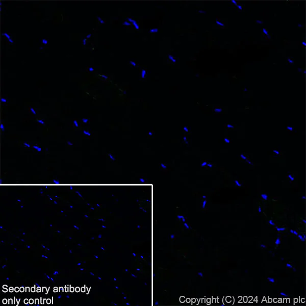 Immunohistochemistry (Frozen sections) - Anti-CD127 antibody [EPR26371-57] - BSA and Azide free (AB318953)