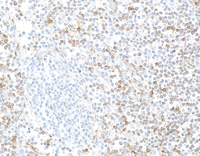 Immunohistochemistry (Formalin/PFA-fixed paraffin-embedded sections) - Anti-CD127/IL-7R alpha antibody [BLR177J] - BSA free (AB314106)
