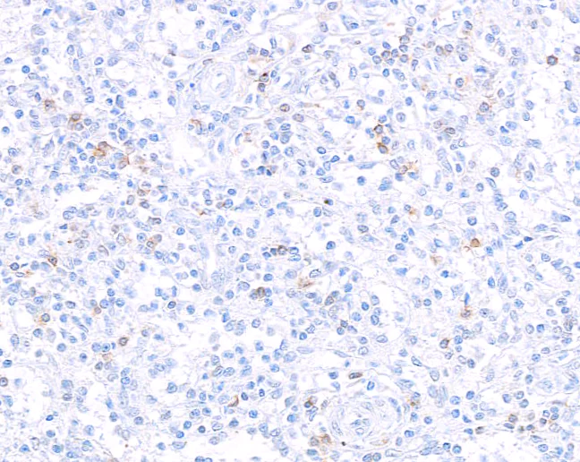 Immunohistochemistry (Formalin/PFA-fixed paraffin-embedded sections) - Anti-CD127/IL-7R alpha antibody [BLR177J] - BSA free (AB314106)