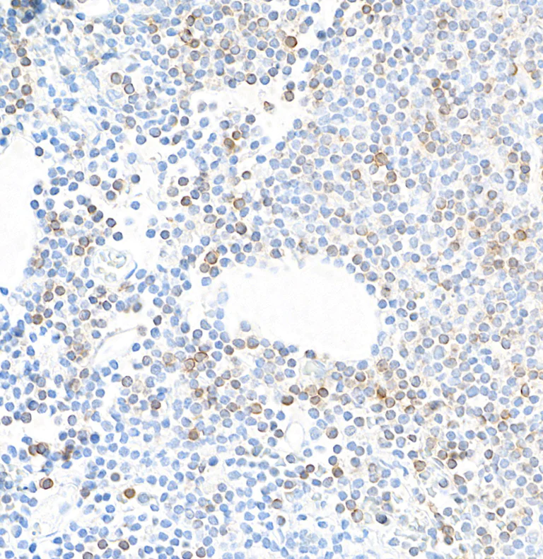 Immunohistochemistry (Formalin/PFA-fixed paraffin-embedded sections) - Anti-CD127/IL-7R alpha antibody [BLR177J] - BSA free (AB314106)