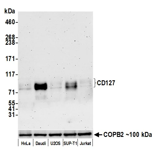 Western blot - Anti-CD127/IL-7R alpha antibody [BLR177J] - BSA free (AB314106)
