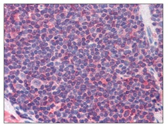 Immunohistochemistry (Formalin/PFA-fixed paraffin-embedded sections) - Anti-CD127 (phospho Y449) antibody (AB118527)