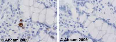 Immunohistochemistry (Formalin/PFA-fixed paraffin-embedded sections) - Anti-CD13 antibody [22A5] (AB20136)