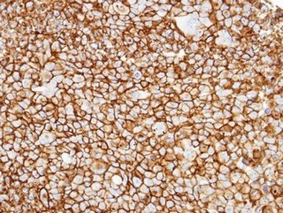 Immunohistochemistry (Formalin/PFA-fixed paraffin-embedded sections) - Anti-CD13 antibody (AB154116)
