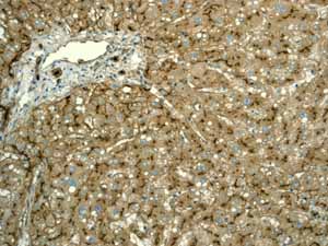 Immunohistochemistry (Formalin/PFA-fixed paraffin-embedded sections) - Anti-CD13 antibody [EPR4058] (ab108310), expandable thumbnail