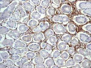 Immunohistochemistry (Formalin/PFA-fixed paraffin-embedded sections) - Anti-CD13 antibody [EPR4058] (ab108310), expandable thumbnail