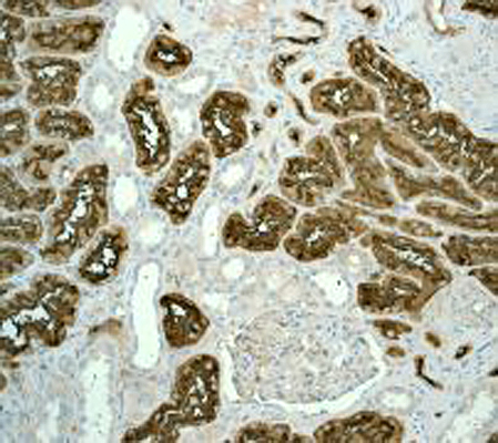 Immunohistochemistry (Formalin/PFA-fixed paraffin-embedded sections) - Anti-CD13 antibody [EPR4058] (ab108310), expandable thumbnail