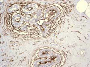 Immunohistochemistry (Formalin/PFA-fixed paraffin-embedded sections) - Anti-CD13 antibody [EPR4058] (AB108310)