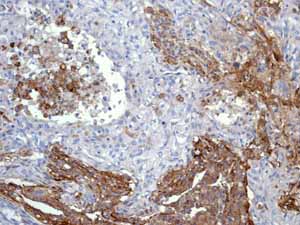 Immunohistochemistry (Formalin/PFA-fixed paraffin-embedded sections) - Anti-CD13 antibody [EPR4058] (ab108310), expandable thumbnail