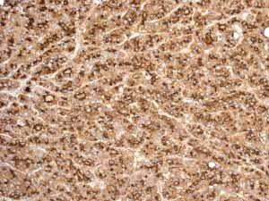Immunohistochemistry (Formalin/PFA-fixed paraffin-embedded sections) - Anti-CD13 antibody [EPR4058] (AB108310)
