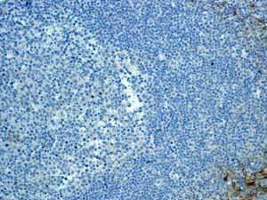 Immunohistochemistry (Formalin/PFA-fixed paraffin-embedded sections) - Anti-CD13 antibody [EPR4058] - BSA and Azide free (AB271872)