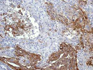 Immunohistochemistry (Formalin/PFA-fixed paraffin-embedded sections) - Anti-CD13 antibody [EPR4058] - BSA and Azide free (AB271872)