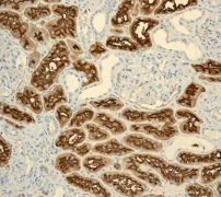 Immunohistochemistry (Formalin/PFA-fixed paraffin-embedded sections) - Anti-CD13 antibody [EPR4059] (AB108382)