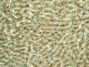 Immunohistochemistry (Formalin/PFA-fixed paraffin-embedded sections) - Anti-CD13 antibody [EPR4059] (AB108382)