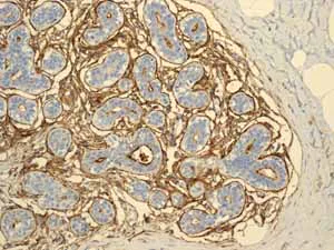 Immunohistochemistry (Formalin/PFA-fixed paraffin-embedded sections) - Anti-CD13 antibody [EPR4059] (AB108382)