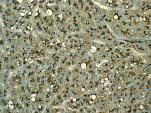 Immunohistochemistry (Formalin/PFA-fixed paraffin-embedded sections) - Anti-CD13 antibody [EPR4059] (AB108382)