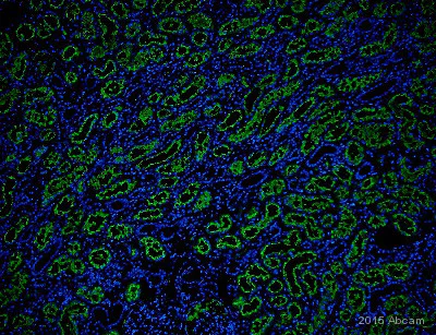 Immunohistochemistry (Formalin/PFA-fixed paraffin-embedded sections) - Anti-CD13 antibody [EPR4059] (AB108382)