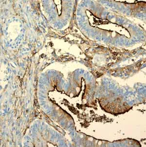 Immunohistochemistry (Formalin/PFA-fixed paraffin-embedded sections) - Anti-CD13 antibody [EPR4059] (AB108382)