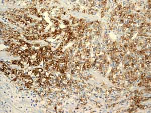 Immunohistochemistry (Formalin/PFA-fixed paraffin-embedded sections) - Anti-CD13 antibody [EPR4059] (AB108382)