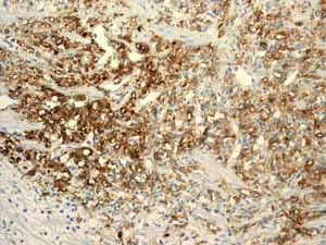Immunohistochemistry (Formalin/PFA-fixed paraffin-embedded sections) - Anti-CD13 antibody [EPR4059] (AB108382)