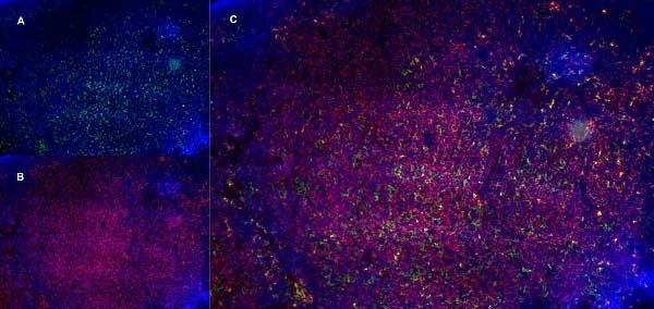 Immunohistochemistry (Formalin/PFA-fixed paraffin-embedded sections) - Anti-CD13 antibody [R3-63] (AB33489)