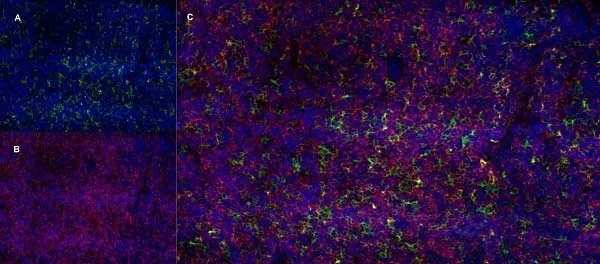 Immunohistochemistry (Formalin/PFA-fixed paraffin-embedded sections) - Anti-CD13 antibody [R3-63] (AB33489)