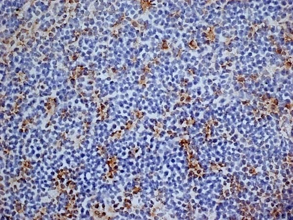 Anti-CD13 antibody [R3-63] (ab33489) | Abcam
