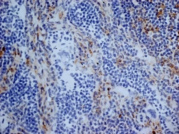 Anti-CD13 antibody [R3-63] (ab33489) | Abcam