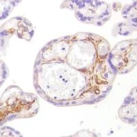 Immunohistochemistry (Formalin/PFA-fixed paraffin-embedded sections) - Anti-CD13 antibody [SP182] (AB183358)