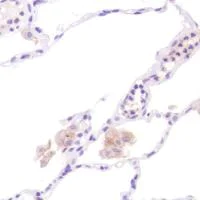 Immunohistochemistry (Formalin/PFA-fixed paraffin-embedded sections) - Anti-CD13 antibody [SP182] (AB183358)