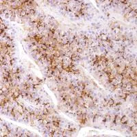 Immunohistochemistry (Formalin/PFA-fixed paraffin-embedded sections) - Anti-CD13 antibody [SP182] (AB183358)