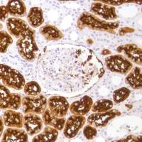Immunohistochemistry (Formalin/PFA-fixed paraffin-embedded sections) - Anti-CD13 antibody [SP182] (AB183358)