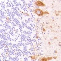 Immunohistochemistry (Formalin/PFA-fixed paraffin-embedded sections) - Anti-CD13 antibody [SP182] (AB183358)