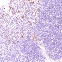 Anti-CD13 antibody [SP182] (ab183358) | Abcam