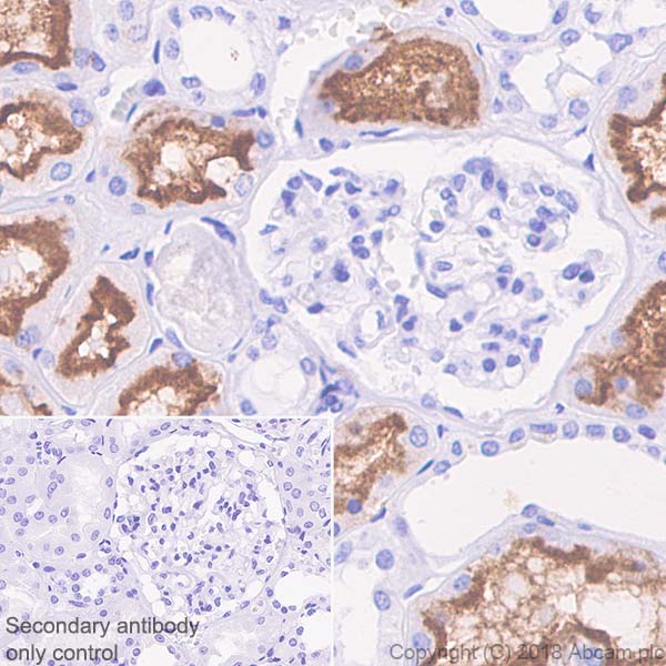 Immunohistochemistry (Formalin/PFA-fixed paraffin-embedded sections) - Anti-CD13 antibody [SP182] - BSA and Azide free (AB243926)