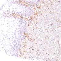 Immunohistochemistry (Formalin/PFA-fixed paraffin-embedded sections) - Anti-CD13 antibody [SP182] - BSA and Azide free (AB243926)
