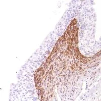 Immunohistochemistry (Formalin/PFA-fixed paraffin-embedded sections) - Anti-CD13 antibody [SP182] - BSA and Azide free (AB243926)