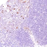 Immunohistochemistry (Formalin/PFA-fixed paraffin-embedded sections) - Anti-CD13 antibody [SP182] - BSA and Azide free (AB243926)