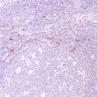 Immunohistochemistry (Formalin/PFA-fixed paraffin-embedded sections) - Anti-CD13 antibody [SP182] - BSA and Azide free (AB243926)