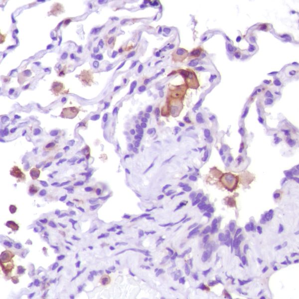 Anti-CD13 antibody [SP187] (ab227663) | Abcam