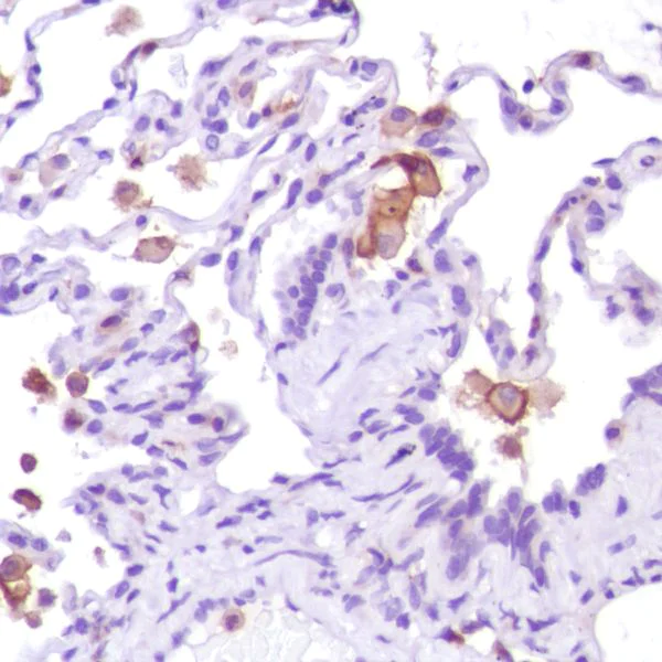 Immunohistochemistry (Formalin/PFA-fixed paraffin-embedded sections) - Anti-CD13 antibody [SP187] (AB227663)